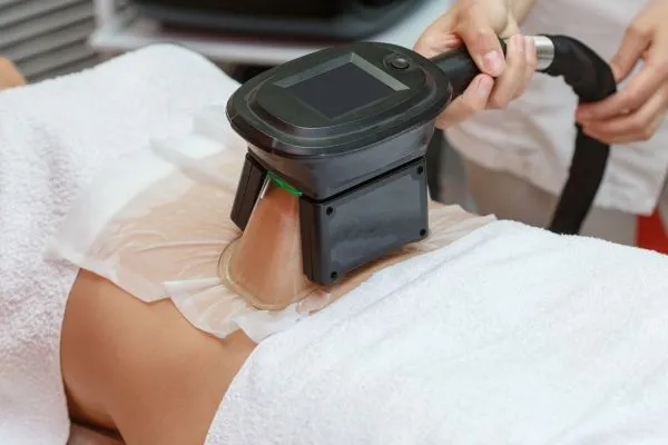 Image of person having fat freezing treatment to help weight gain Winslow