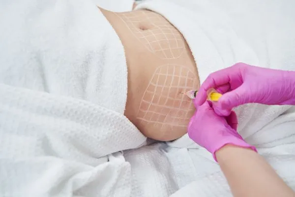 image of fat dissolving injections on love handles to help combat weight gain Winslow