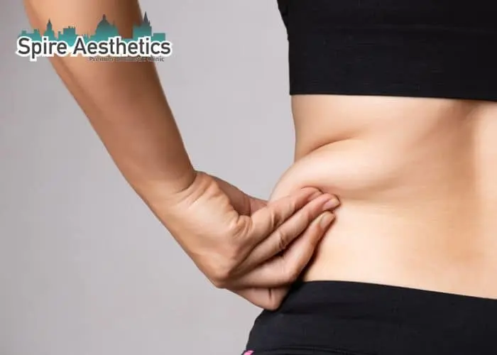 Image of woman pinching fat on their hips Winslow. Fat Freezing treatment 