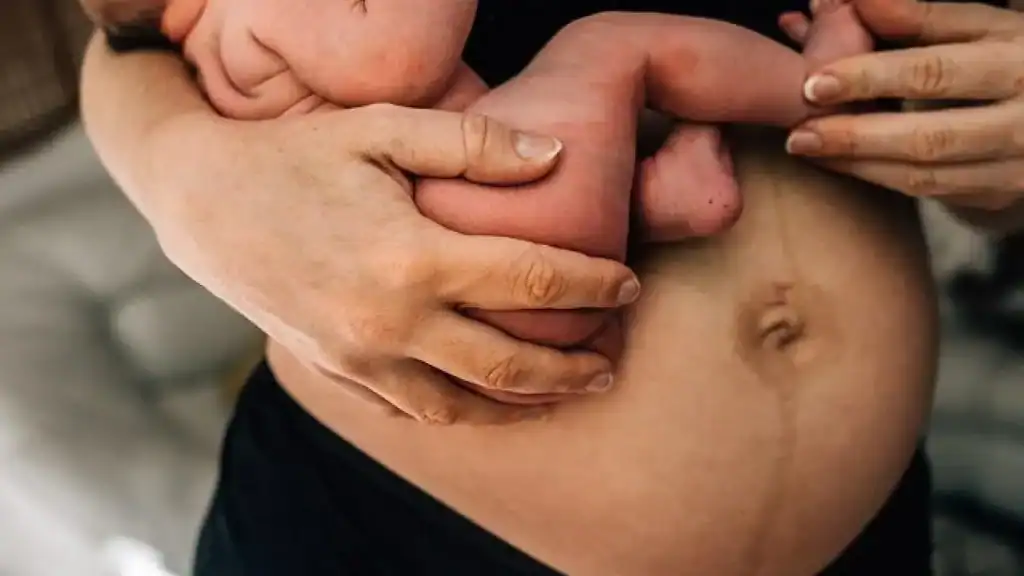 Why Is My Stomach Still Big After Pregnancy Winslow?